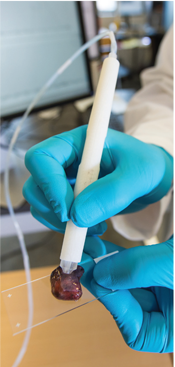DEMONSTRATION OF THE ENGINEERED PEN ON A HUMAN TISSUE SAMPLE